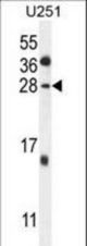 GGTLC2 Antibody western blot of U251 cell line lysates (35 ug/lane). The GGTLC2 antibody detected the GGTLC2 protein (arrow).
