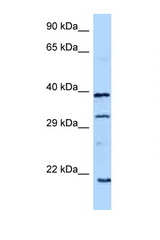 GH1 / Growth Hormone antibody LS-C146263 Western blot of 1 Cell lysate. Antibody concentration 1 ug/ml.