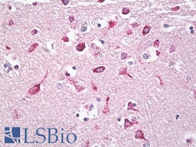 Anti-GH / HGH antibody IHC of human brain, cortex. Immunohistochemistry of formalin-fixed, paraffin-embedded tissue after heat-induced antigen retrieval. Antibody LS-B8263 dilution 5-10 ug/ml.