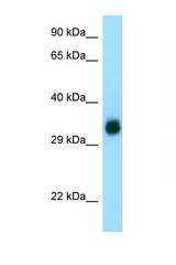 GGH / HGH antibody LS-B8263 Western blot of Fetal Kidney lysate. Antibody concentration 1 ug/ml.
