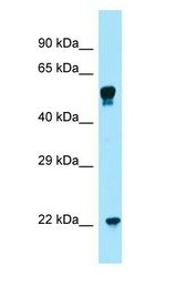 COQ7 antibody Western Blot of THP-1 cell lysate.