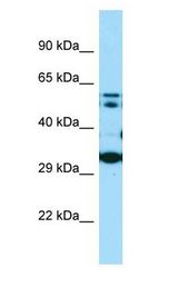 COQ7 antibody Western Blot of MDA-MB-435S.