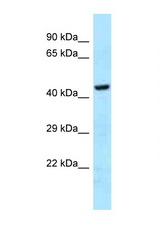 GHDC antibody LS-C146004 Western blot of 721_B Cell lysate. Antibody concentration 1 ug/ml.