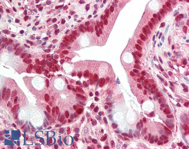 Anti-GHDC antibody IHC staining of human small intestine. Immunohistochemistry of formalin-fixed, paraffin-embedded tissue after heat-induced antigen retrieval.