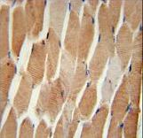 COQ7 Antibody immunohistochemistry of formalin-fixed and paraffin-embedded human skeletal muscle followed by peroxidase-conjugated secondary antibody and DAB staining.