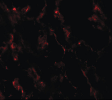 Immunofluorescence of GHDC1 in human breast tissue with GHDC1 antibody at 20 ug/ml.
