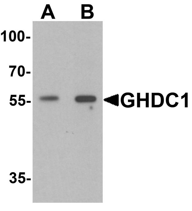 Western blot analysis of GHDC in 293 cell lysate with GHDC antibody at (A) 0.5 and (B) 1 ug/ml.