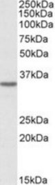 GHITM antibody (0.3 ug/ml) staining of HeLa cell lysate (35 ug protein/ml in RIPA buffer). Primary incubation was 1 hour. Detected by chemiluminescence.