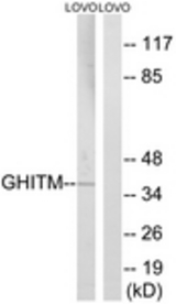 Western blot of extracts from LOVO cells, using GHITM Antibody. The lane on the right is treated with the synthesized peptide.