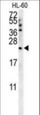 COQ7 Antibody western blot of HL-60 cell line lysates (35 ug/lane). The COQ7 antibody detected the COQ7 protein (arrow).