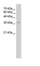 Jurkat Cell Lysate