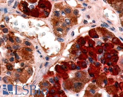 Anti-GHRHR antibody LS-A835 IHC of human pituitary, anterior. Immunohistochemistry of formalin-fixed, paraffin-embedded tissue after heat-induced antigen retrieval.