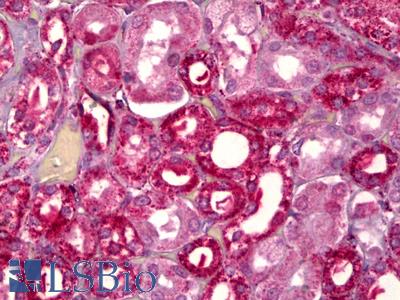 Anti-GHRHR antibody IHC of human kidney, tubules. Immunohistochemistry of formalin-fixed, paraffin-embedded tissue after heat-induced antigen retrieval. Antibody LS-B6566 concentration 5 ug/ml.