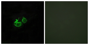 Immunofluorescence of HUVEC cells, using GHRHR Antibody. The picture on the right is treated with the synthesized peptide.