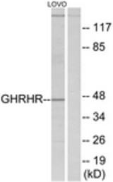 Western blot of extracts from LOVO cells, using GHRHR Antibody. The lane on the right is treated with the synthesized peptide.