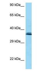 COQ9 antibody Western Blot of HCT15.