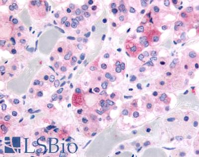 Anti-Ghrelin Receptor antibody LS-A6576 IHC of human pituitary, anterior. Immunohistochemistry of formalin-fixed, paraffin-embedded tissue after heat-induced antigen retrieval.