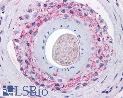 Anti-Ghrelin Receptor antibody LS-A581 IHC of human skin, hair follicle. Immunohistochemistry of formalin-fixed, paraffin-embedded tissue after heat-induced antigen retrieval.