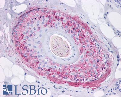 Anti-Ghrelin Receptor antibody LS-A582 IHC of human skin, hair follicle. Immunohistochemistry of formalin-fixed, paraffin-embedded tissue after heat-induced antigen retrieval.