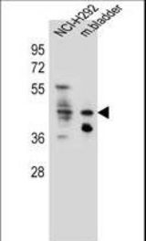 GHSR Antibody western blot of NCI-H292 cell line and mouse bladder tissue lysates (35 ug/lane). The GHSR antibody detected the GHSR protein (arrow).