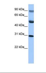 HepG2 cell lysate. Antibody concentration: 1.0 ug/ml. Gel concentration: 12%.