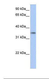 Fetal muscle lysate. Antibody concentration: 1.0 ug/ml. Gel concentration: 12%.