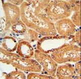 COQ9 Antibody immunohistochemistry of formalin-fixed and paraffin-embedded human lung tissue followed by peroxidase-conjugated secondary antibody and DAB staining.