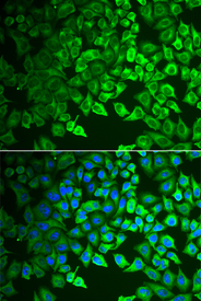 Immunofluorescence analysis of A549 cell using GIF antibody. Blue: DAPI for nuclear staining.