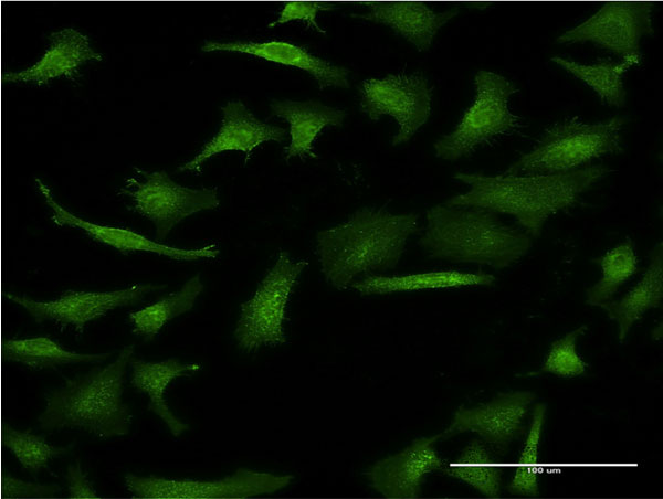 Immunofluorescence of monoclonal antibody to GIF on HeLa cell . [antibody concentration 10 ug/ml]