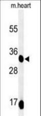Western blot of COQ9 Antibody in mouse heart tissue lysates (35 ug/lane). COQ9 (arrow) was detected using the purified antibody.