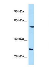 GIMAP4 antibody LS-C145356 Western blot of HeLa Cell lysate. Antibody concentration 1 ug/ml.
