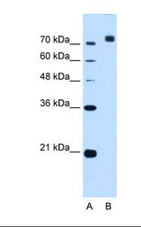 Lane A: Marker. Lane B: HepG2 cell lysate. Antibody concentration: 2.5 ug/ml. Gel concentration: 12%.
