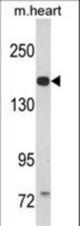 Western blot of CORIN Antibody in mouse heart tissue lysates (35 ug/lane). CORIN (arrow) was detected using the purified antibody.