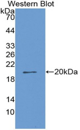 Western blot of recombinant CORIN.