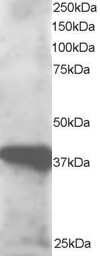 Antibody staining (0.5 ug/ml) of human lymph node lysate (RIPA buffer, 30 ug total protein per lane). Primary incubated for 1 hour. Detected by Western blot of chemiluminescence.
