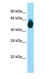GIPR / GIP Receptor antibody Western Blot of 293T cell lysate.