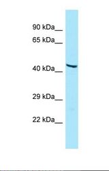 Western blot of Human HT1080. GIPR antibody dilution 1.0 ug/ml.