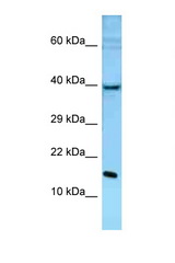 POLE3 antibody LS-C146393 Western blot of Mouse Liver lysate. Antibody concentration 1 ug/ml.