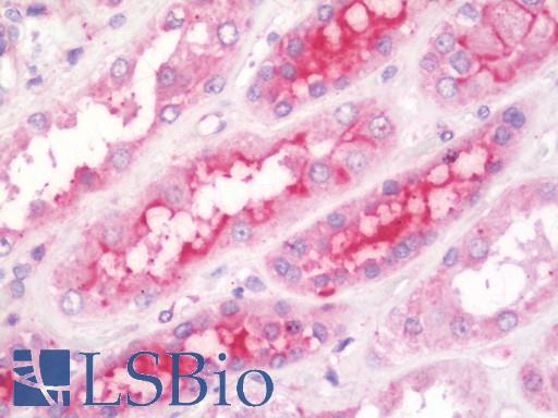 Anti-GIT2 antibody IHC staining of human kidney. Immunohistochemistry of formalin-fixed, paraffin-embedded tissue after heat-induced antigen retrieval. Antibody LS-B10868 concentration 7.5 ug/ml.