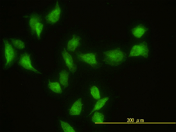 Immunofluorescence of monoclonal antibody to GIT2 on HeLa cell. [antibody concentration 20 ug/ml]