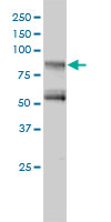 GIT2 monoclonal antibody, clone 3B5-B9 Western blot of GIT2 expression in Jurkat.