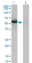 Western blot of GIT2 expression in transfected 293T cell line by GIT2 monoclonal antibody, clone 3B5-B9.