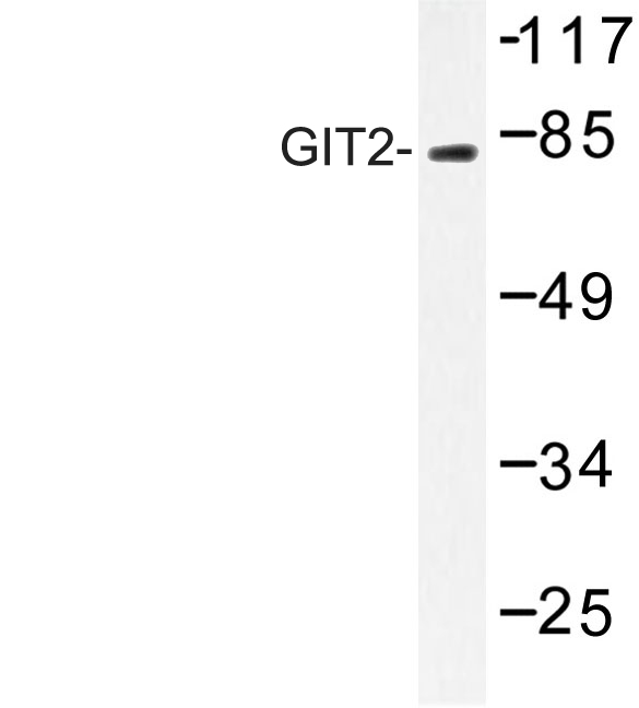 Western blot of GIT2 (D391) pAb in extracts from HepG2 cells.