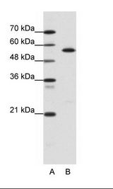 A: Marker, B: Daudi Cell Lysate