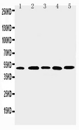 WB of GJA3 / CX46 / Connexin 46 antibody. Lane 1: HELA Cell Lysate. Lane 2: A431 Cell Lysate. Lane 3: JURKAT Cell Lysate. Lane 4: SMMC Cell Lysate. Lane 5: A549 Cell Lysate.
