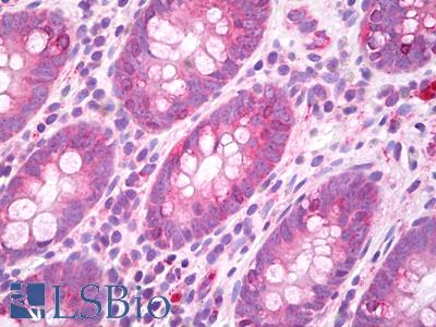 Anti-GJA3 / Connexin 46 antibody IHC of human colon. Immunohistochemistry of formalin-fixed, paraffin-embedded tissue after heat-induced antigen retrieval. Antibody LS-B7775 dilution 10 ug/ml.