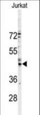 Western blot of GJA3 Antibody in Jurkat cell line lysates (35 ug/lane). GJA3 (arrow) was detected using the purified antibody.
