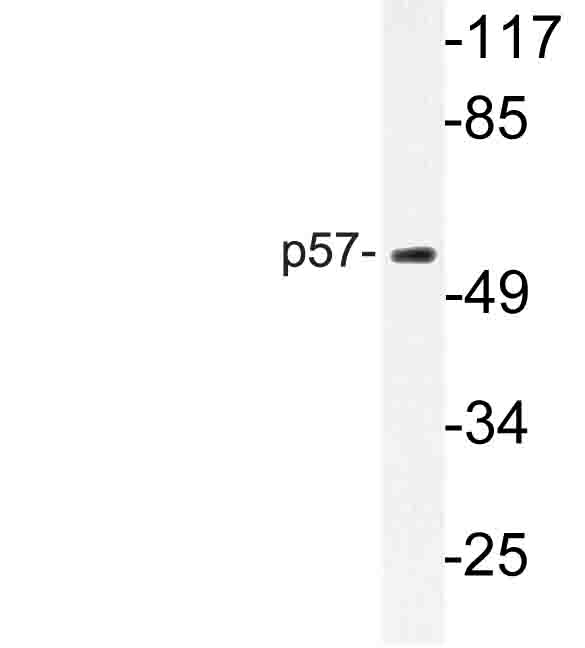Western blot of p57 (S306) pAb in extracts from K562 cells.