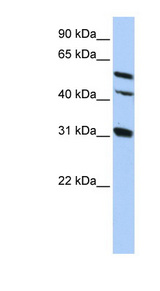 GJA8 antibody LS-C110181 Western blot of HepG2 cell lysate.