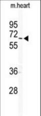 Western blot of GJA10 Antibody in mouse heart tissue lysates (35 ug/lane). GJA10 (arrow) was detected using the purified antibody.